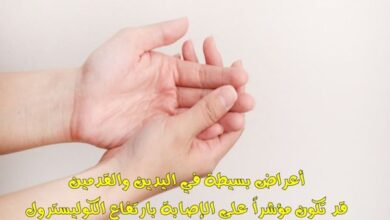 من أعراض الإصابة بارتفاع الكوليسترول